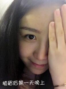 眉毛種植價格4800元,植眉果和成長過程分享