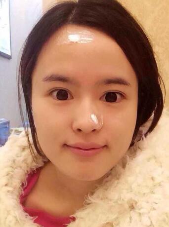 眉毛種植術(shù)前準(zhǔn)備圖