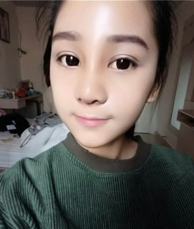 隆鼻整形日記，像變了個人似的