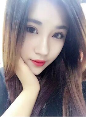 切開雙眼皮恢復(fù)過程 真實經(jīng)歷分享一下