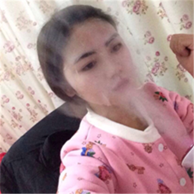 磨下頜角磨顴骨手術(shù)恢復(fù)過程和前后對比果照片分享哦~