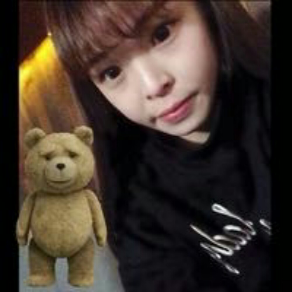 玻尿酸注射墊下巴和隆鼻前后對比果圖片分享，孫中生做的~