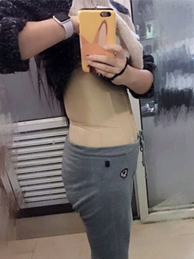 腰腹吸脂手術(shù)后，我也擁有“小蠻腰”啦!