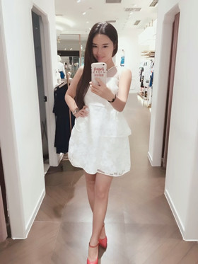 腰腹吸脂手術(shù)后，我也擁有“小蠻腰”啦!