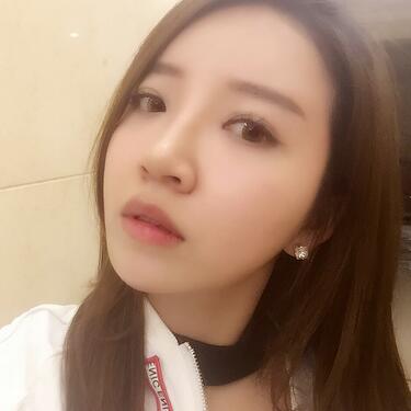 自體脂肪填充全臉1個月經(jīng)歷