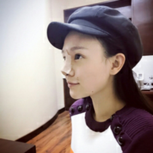 隆鼻整形手術(shù)恢復(fù)過程照片分享，看看前后對(duì)比果~