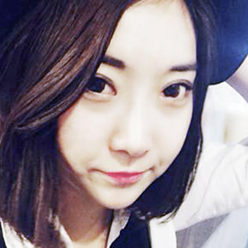 米蘭柏羽做了外切去眼袋，分享手術(shù)前后對比果圖片哦~