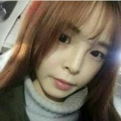 玻尿酸注射隆鼻三個月了，分享術后恢復照片哇~