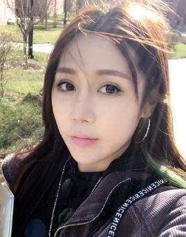 隆鼻整形第八天,拆線了