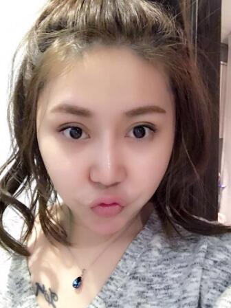 鼻子整形2個多月了,差不多基本恢復(fù)了,可以任意揉捏