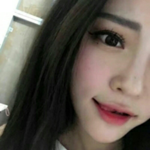 做了隆鼻整形手術(shù)好看多了，分享前后對比果照片~