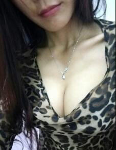 假體隆胸3個(gè)月,腋下傷口已經(jīng)基本恢復(fù)