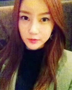 地包天手術(shù)前后過程以及對比照，真實(shí)案例分享