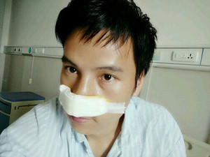 記錄了隆鼻整形（膨體隆鼻+鼻翼縮小）手術(shù)前后的過程，還有對比照片哦