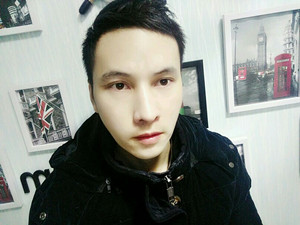 記錄了隆鼻整形（膨體隆鼻+鼻翼縮?。┦中g(shù)前后的過程，還有對比照片哦