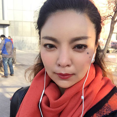 自體脂肪隆鼻手術(shù)恢復(fù)過(guò)程分享，還有前后對(duì)比果圖片哦~