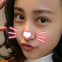 割雙眼皮恢復過程分享，整形價格3800元