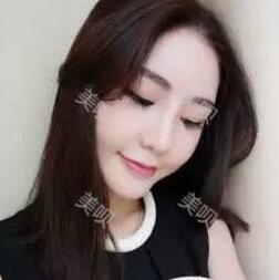 杭州廣仁做的硅膠假體隆鼻+鼻翼縮小我很滿意