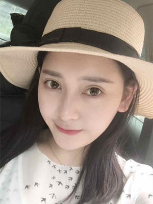 自體軟骨隆鼻手術(shù)前后過(guò)程以及對(duì)比照片分享