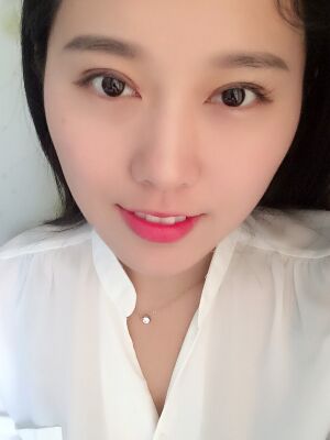 雙眼皮失敗修復(fù)手術(shù)恢復(fù)超自然，看起來一點都不假