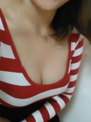 自體脂肪隆胸后胸變得豐滿，腿也細(xì)了很多