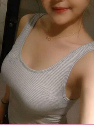 自體脂肪隆胸后胸變得豐滿，腿也細(xì)了很多