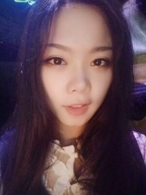 全切雙眼皮手術(shù)，送給自己的成年禮物