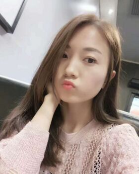 激光去眼袋成好嗎，看看我就知道啦