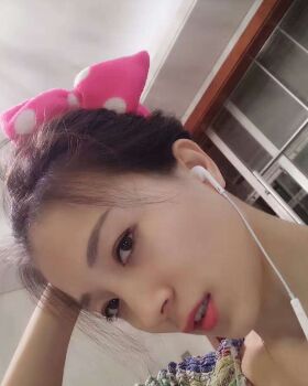 激光去眼袋成好嗎，看看我就知道啦