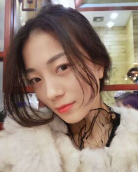 激光去眼袋成好嗎，看看我就知道啦