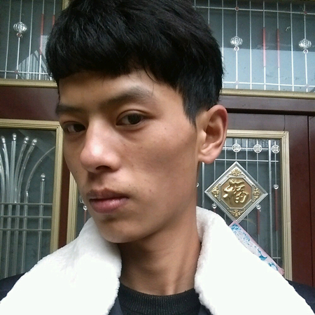 內(nèi)切去眼袋+切開(kāi)割雙眼皮恢復(fù)過(guò)程和前后對(duì)比果圖片分享哦~