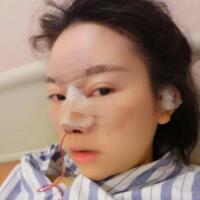 鼻子整形價(jià)格10000元，隆鼻手術(shù)過程圖分享