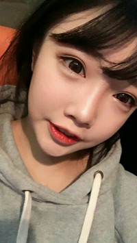 顴骨整形手術(shù)后，我也可以擁有精致小臉了