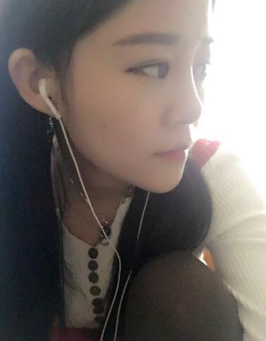 玻尿酸隆鼻恢復(fù)過(guò)程圖