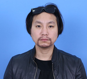 種植胡須手術(shù)前后過(guò)程以及對(duì)比照片分享