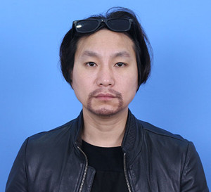 種植胡須手術(shù)前后過(guò)程以及對(duì)比照片分享