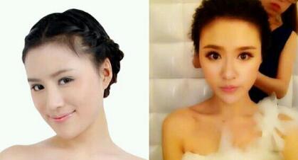 磨骨后下頜角恢復(fù)好后，覺得果很好，我又去做了鼻部整形，墊了下吧