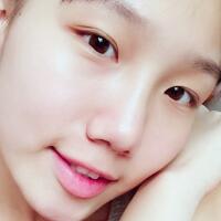 玻尿酸隆鼻，塌鼻梁變嬌俏鼻真實(shí)經(jīng)歷分享