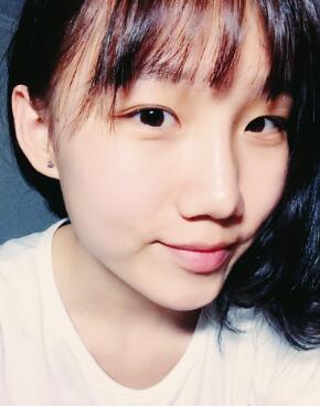 注射玻尿酸隆鼻第五天