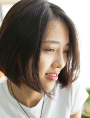 割雙眼皮+開(kāi)眼角+隆鼻整形