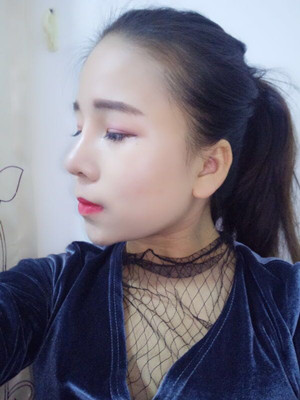 廣州廣美做的假體隆鼻，給大家分享一下手術(shù)前后過程以及對(duì)比照片