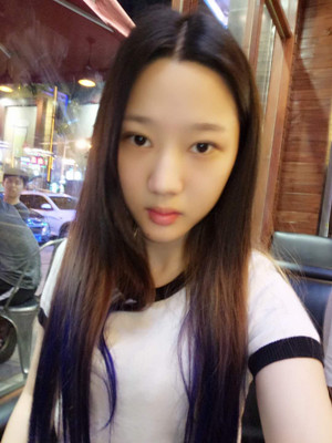 切開雙眼皮+假體隆下巴，我不再是典型的路人甲