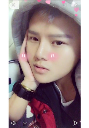 玻尿酸隆鼻+墊下巴親身經歷~~果不錯哦