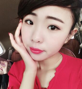 割雙眼皮術(shù)后恢復(fù)過程 全切雙眼皮3個月