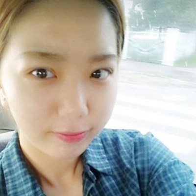 埋線雙眼皮手術(shù)兩個月了，分享術(shù)后恢復(fù)的照片呢~