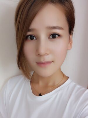 隆鼻和雙眼皮修復(fù)一起做的，現(xiàn)在氣質(zhì)提升好多