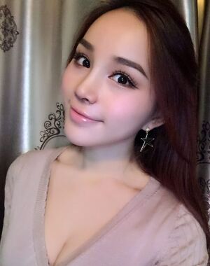 隆鼻整形+硅膠墊下巴前后對(duì)比照片給大家瞅瞅