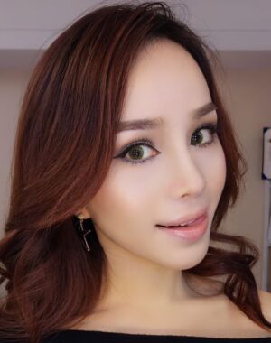 隆鼻整形+硅膠墊下巴前后對(duì)比照片給大家瞅瞅