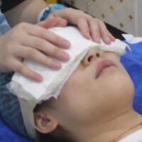 去眼袋手術(shù)多少錢？做了激光去眼袋價格5800元，恢復很好