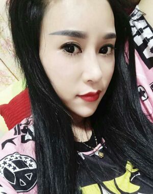 牛永敢做的隆鼻失敗修復(fù)，對(duì)比很明X哦~